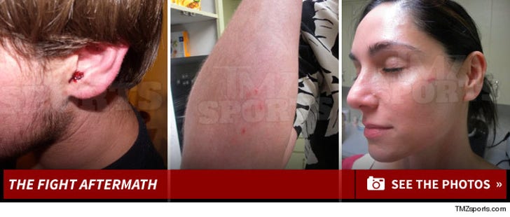 Hope Solo Fight -- The Injury Aftermath