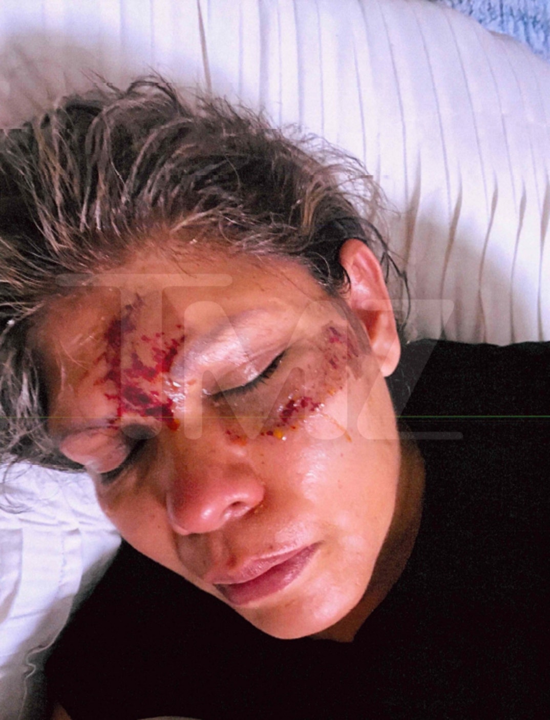 Cut Up Face 1