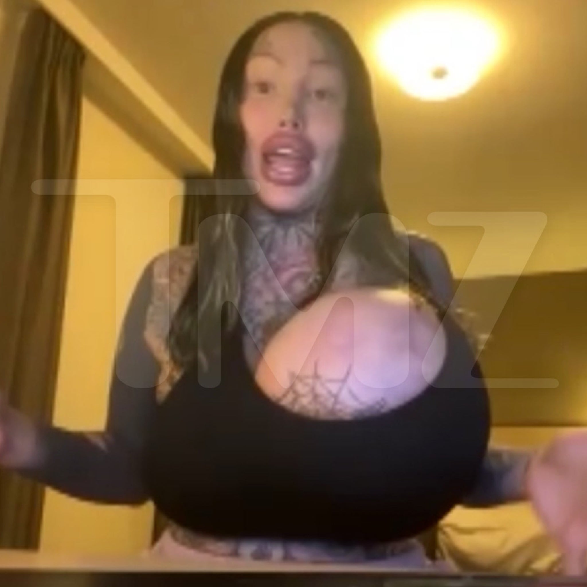 Uni-Boob IG Model Says She's Not Mentally Ill, Surgery Is Her