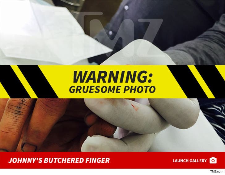 Johnny Depp's Gruesome Finger