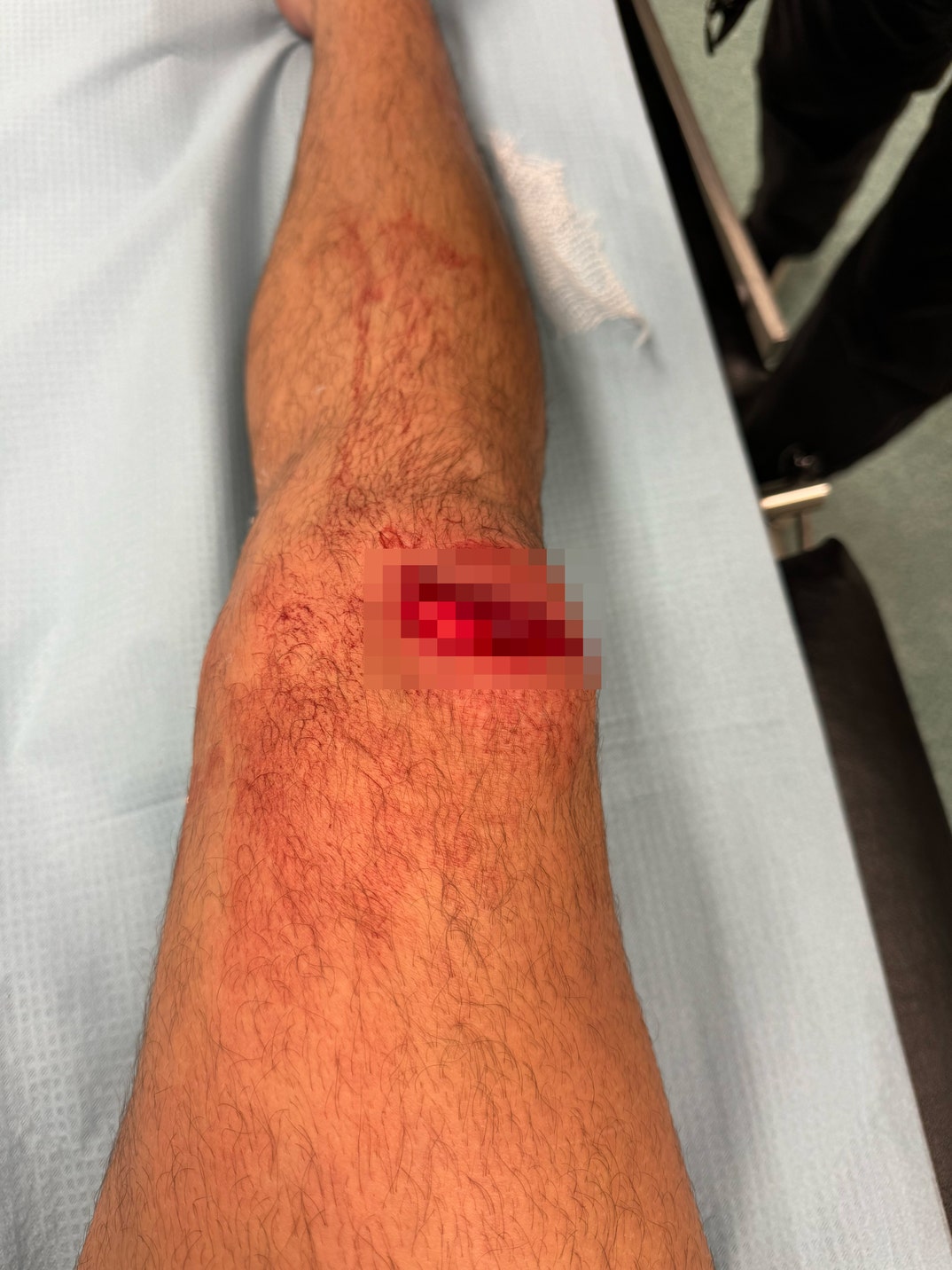 Logan Henderson Knee Blur