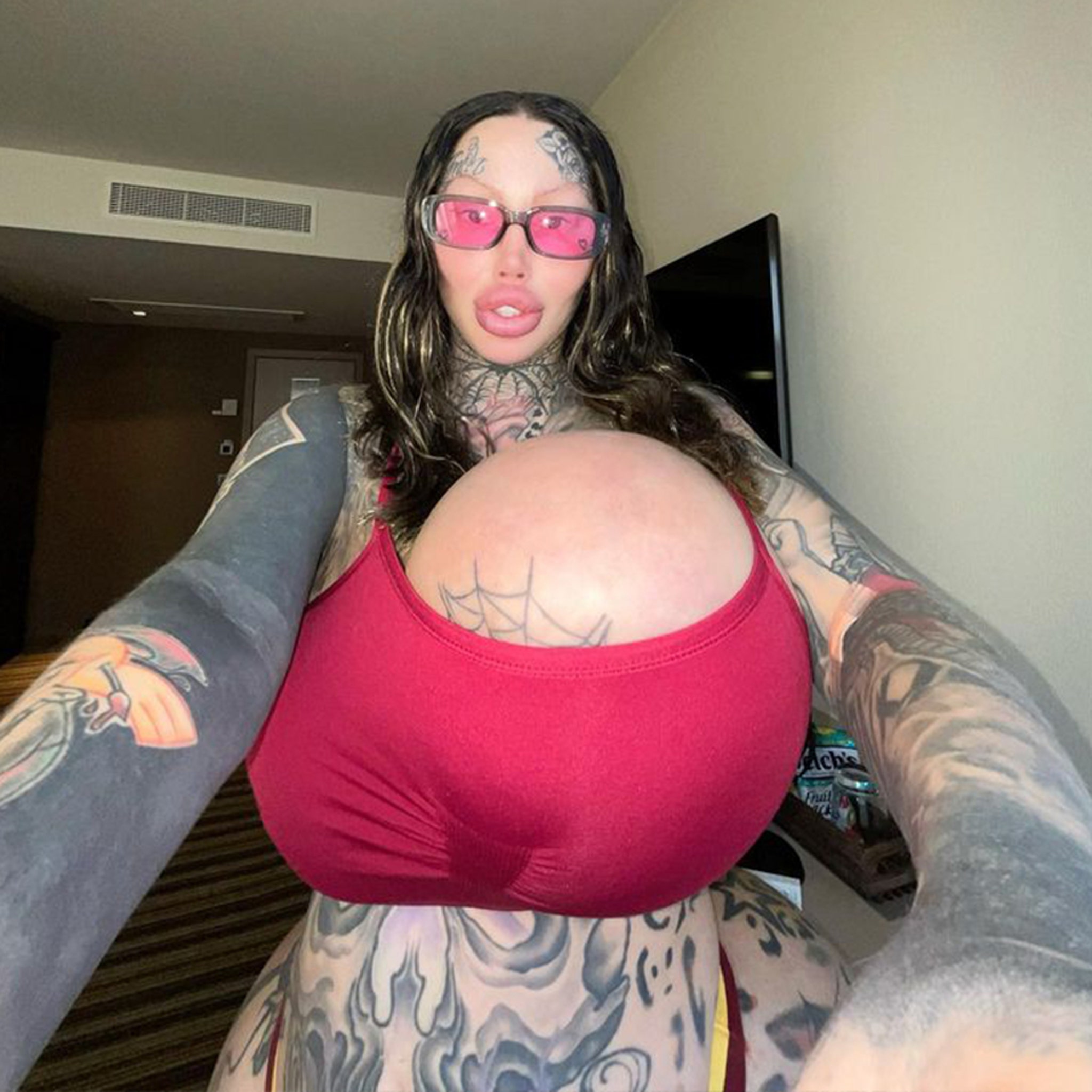 Instagram Models Massive 38J Breast Implant Bursts