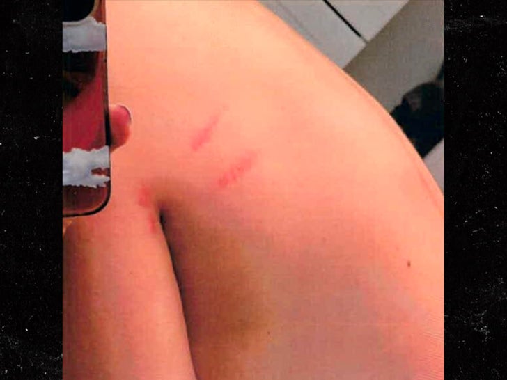0714-Columbus-Short-Wife-Injury-SUB