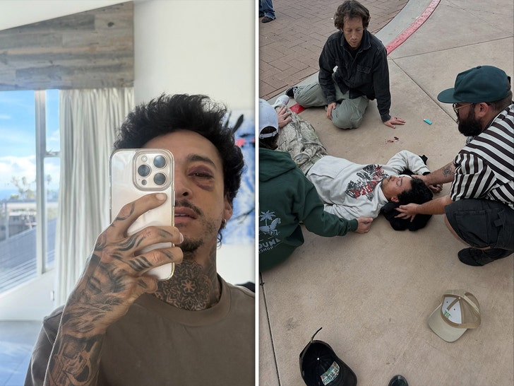 Nyjah Huston Fractures Skull insta 5
