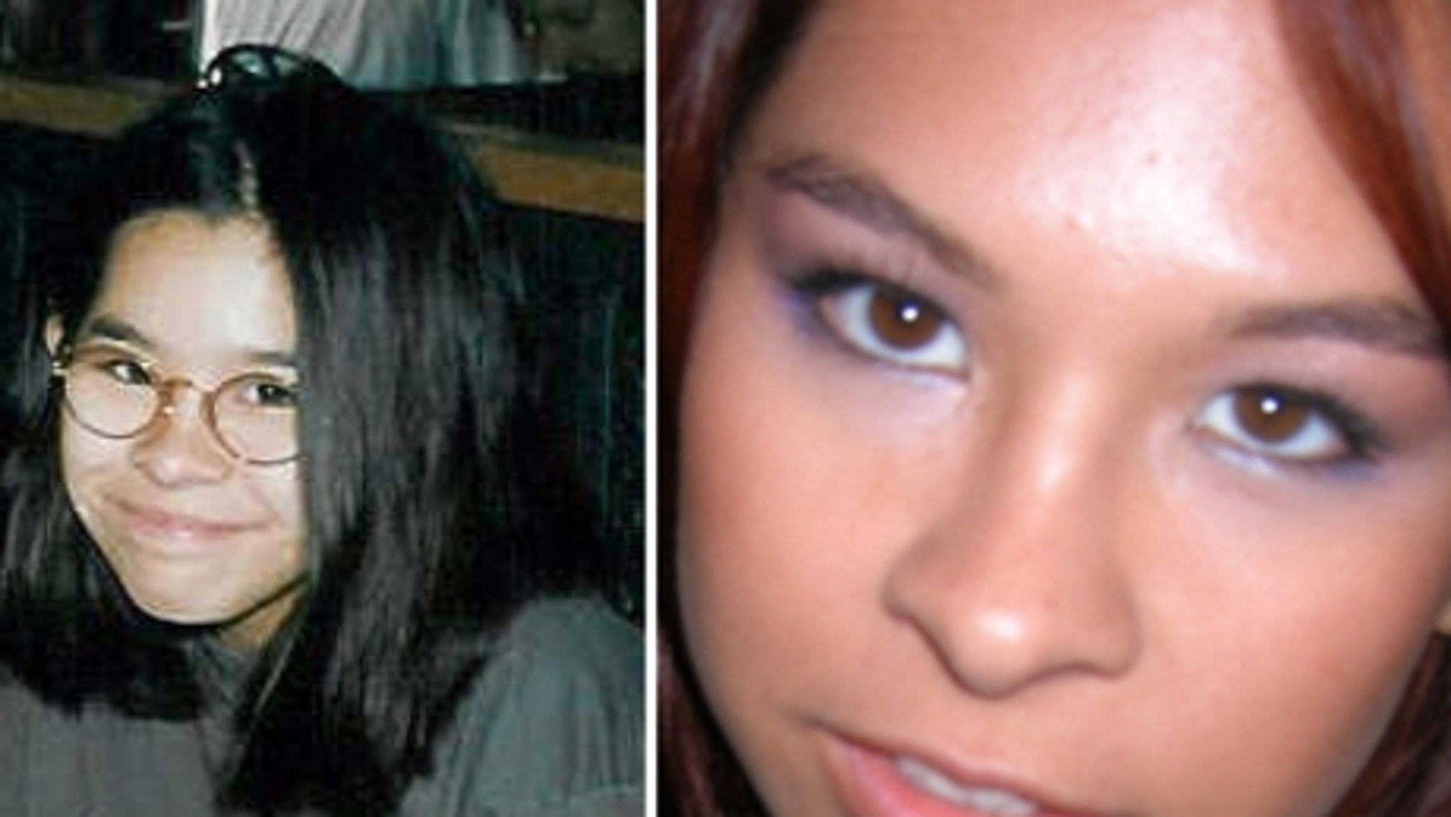 traci melchor plastic surgery Image 9