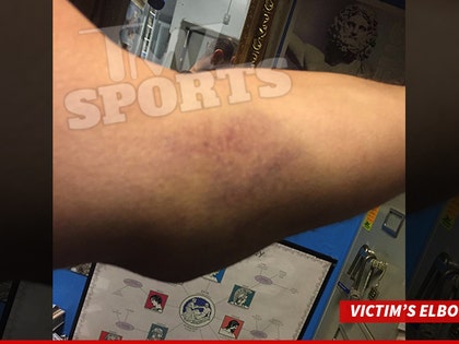 1124-manziel-victim-elbow-tmz-01