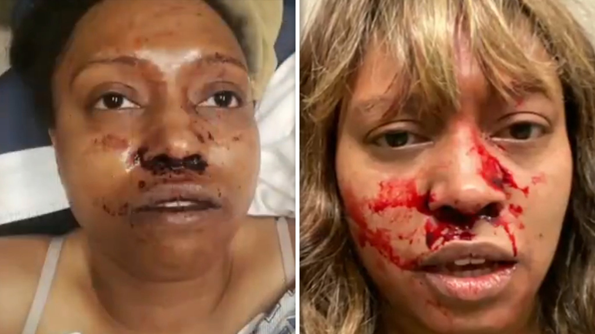 Chad Wheeler victim Alleah Taylor reveals photos of disturbing injury and wants an NFL player in prison