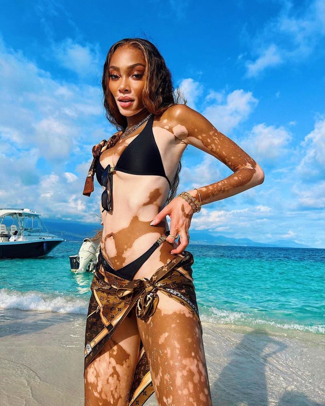 0726 Winnie Harlow Hot Shots 13