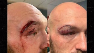 Tyson Fury Gets 50 Stitches to Close Massive Gash after Otto Wallin Fight