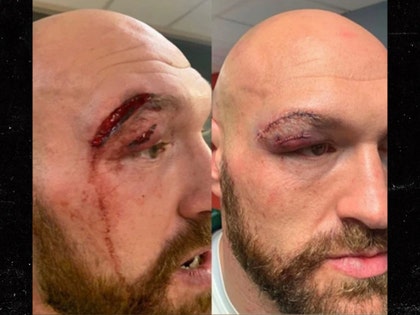 0916-tyson-fury-instagram-01