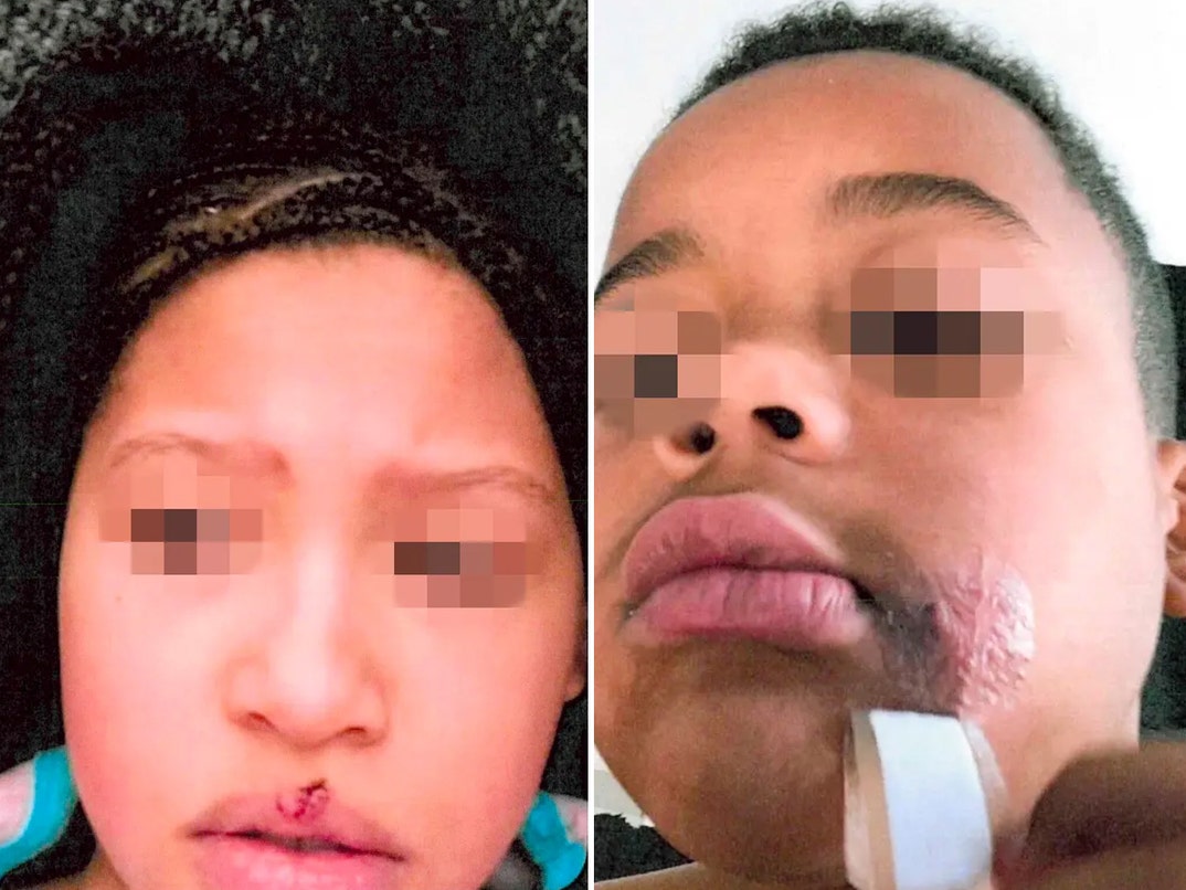 aaron donald kids dog bites reveal
