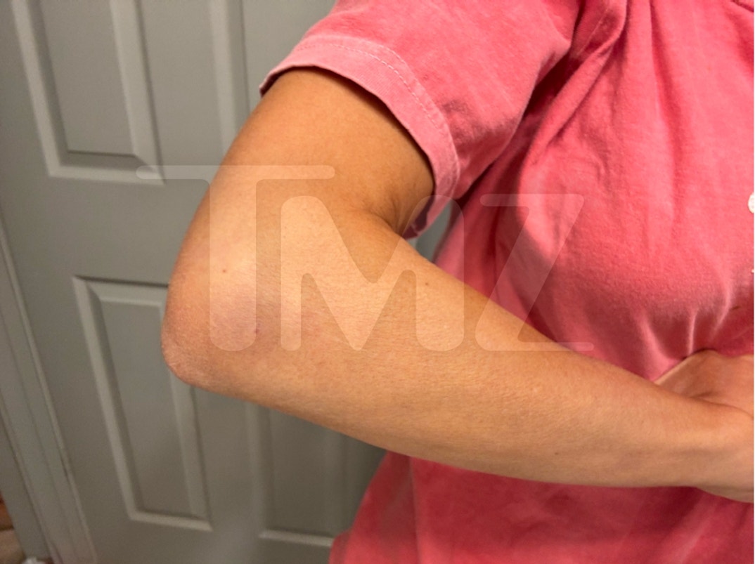 Taylor Frankie Paul Alleged Injuries  5